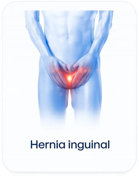 Hernia inguinal
