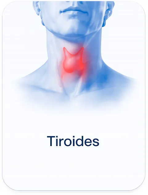 Tiroides