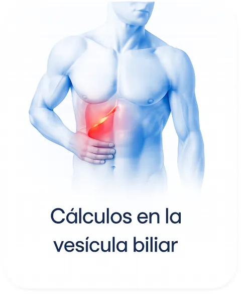 Piedras en la vesícula